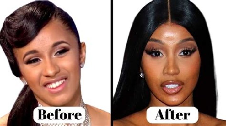 "Cardi Before And After Pictures" Unveiled