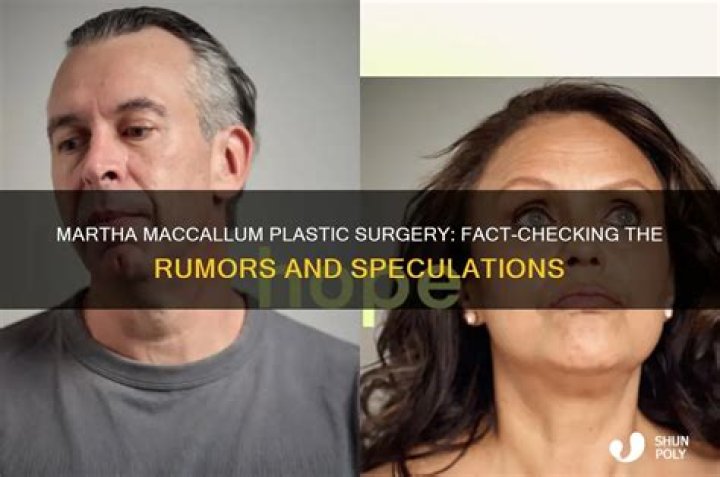 Did Martha MacCallum Have Cosmetic Surgery? Exploring Public Speculation