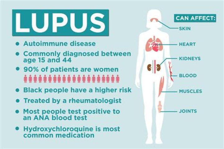 Discoveries And Insights In Lupus Disease