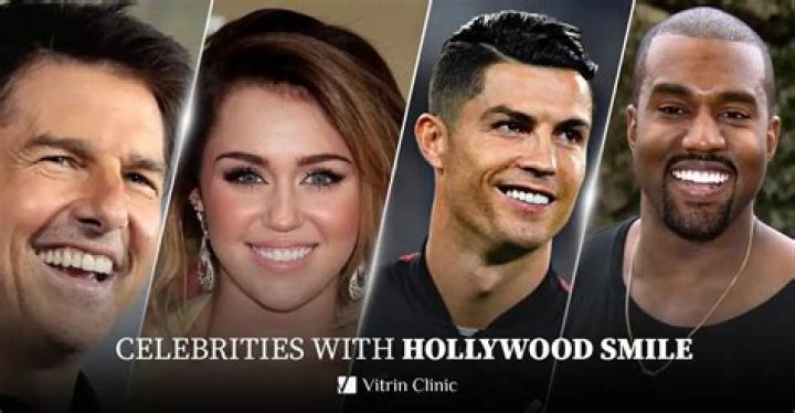 Does JLO Have Veneers? Unpacking That Famous Smile