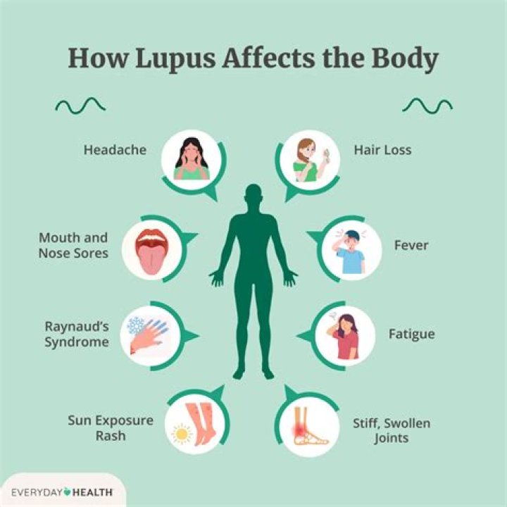 Does Lupus Cause Weight Gain? Exploring the Connections