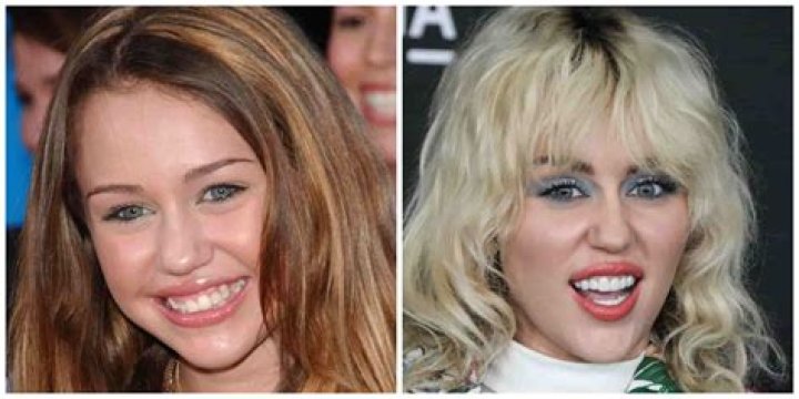 Does Miley Cyrus Have Dentures? Unpacking the Buzz About Her Smile