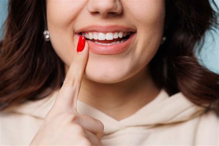 Does Oprah Wear Dentures? Unpacking the Truth About Her Famous Smile