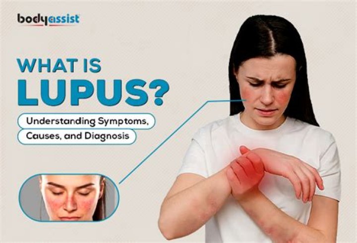 How Does Someone Get Lupus? Unraveling the Mystery