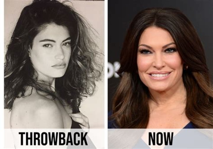 Kimberly Guilfoyle Before Plastic Surgery