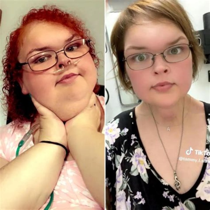 Liberty Love Island: The Transformation Before And After Surgery