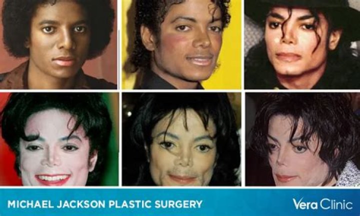 Sidney Sweeney's Plastic Surgery Journey