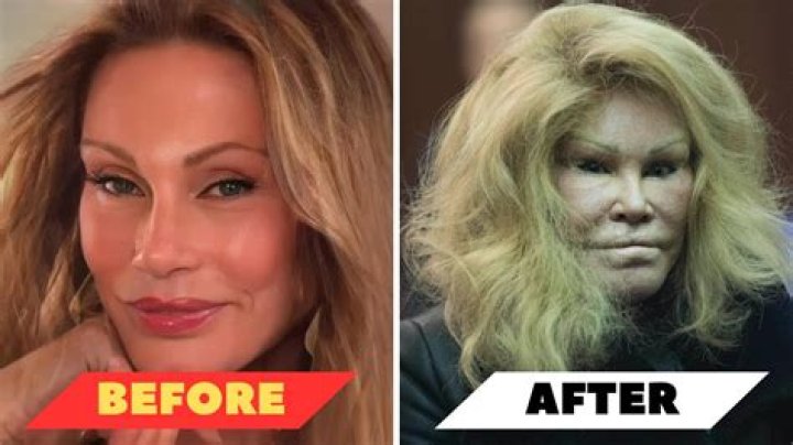 Toni Fowler Before Plastic Surgery: Truth Or Myth?