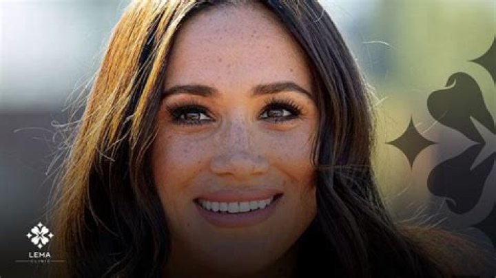 Unveiling Charlotte Le Bon's Smile Transformation: Discoveries And Insights
