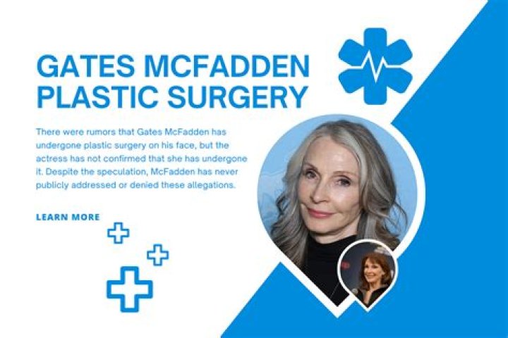 Unveiling Gates McFadden's Plastic Surgery Journey: Discoveries And Insights