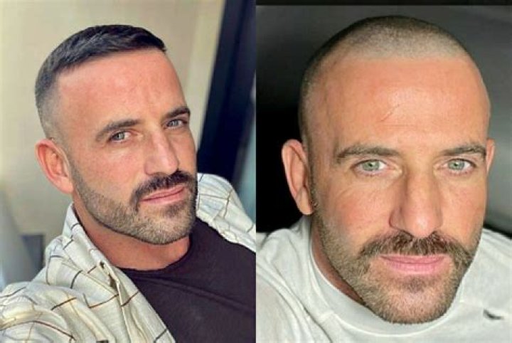 Unveiling The Empowering World Of Celebrity Women Embracing Baldness For A Thriving Society