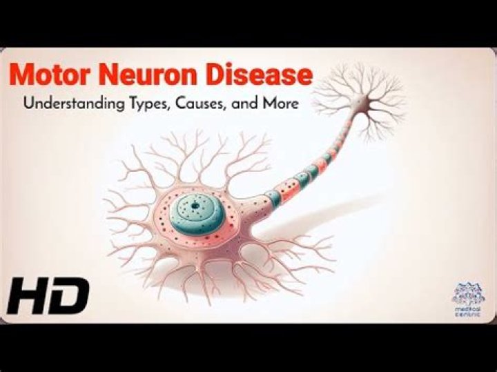 Unveiling The Enigma Of Motor Neurone Disease