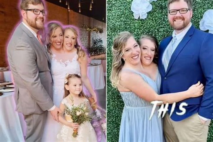 Unveiling The Heartfelt Journey Of Abby And Brittany Hensel: Sad News And Beyond