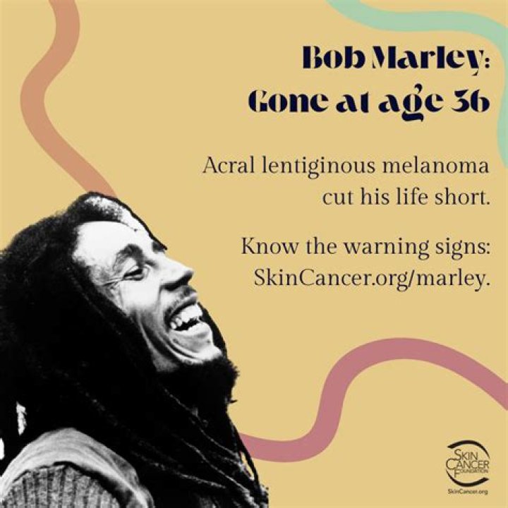 Unveiling The Truth Behind Bob Marley's Skin Cancer: A Journey Of Discovery