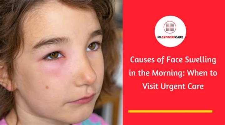 Who is the Girl with the Swollen Face in Grey's Anatomy? Uncovering a Memorable Patient Story