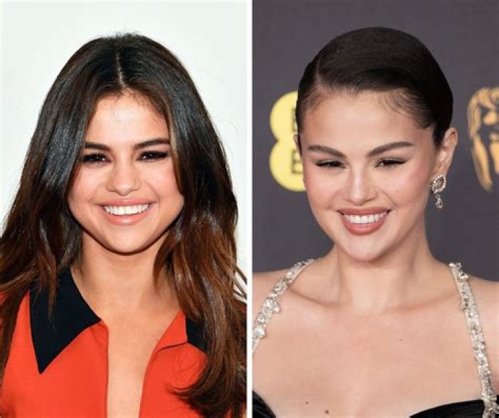 Why Does Selena Gomez's Face Look So Different? Exploring the Changes
