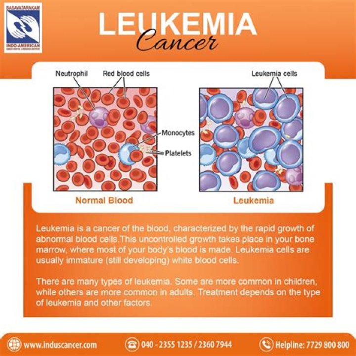 Why is Leukemia Not Staged Like Other Cancers? Unraveling the Difference
