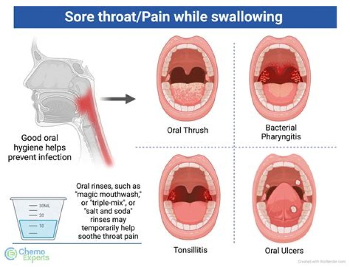 Will Sprite Soothe Your Sore Throat?